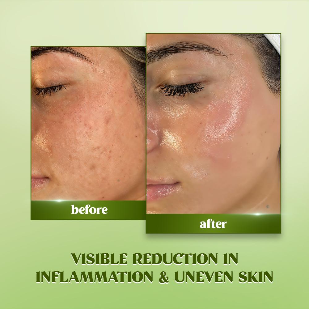 RENEE Matcha Face Serum For Hydration and Glow, 30ml