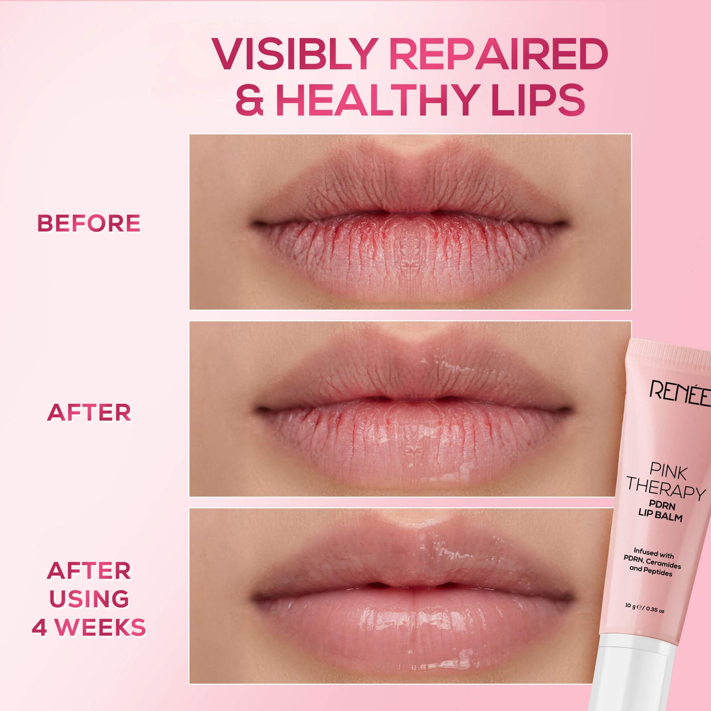 RENEE Pink Therapy Anti-Aging Complete Skincare Set