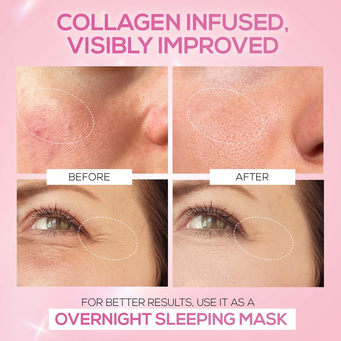 RENEE Pink Therapy Hydrolyzed Collagen Overnight Sleeping Jelly Mask for Anti-Aging & Hydrated Skin