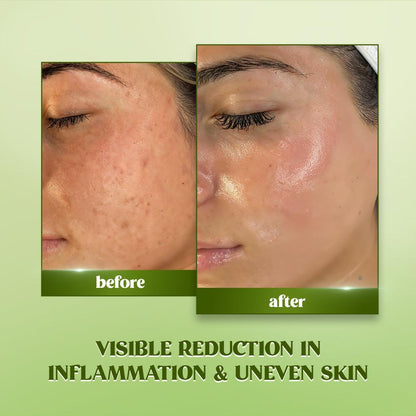 RENEE Matcha Face Serum For Hydration and Glow, 30ml