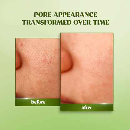 RENEE Matcha Refreshing Face Toner For Bright, Hydrated Skin