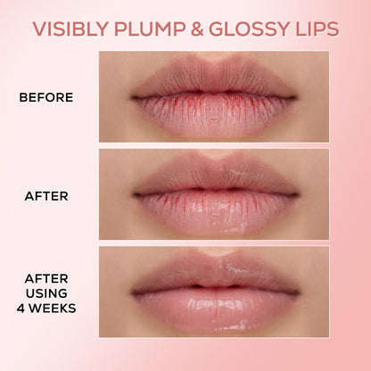 RENEE Pink Therapy PDRN Moisturising Lip Balm For Dry & Chapped Lips, 10g