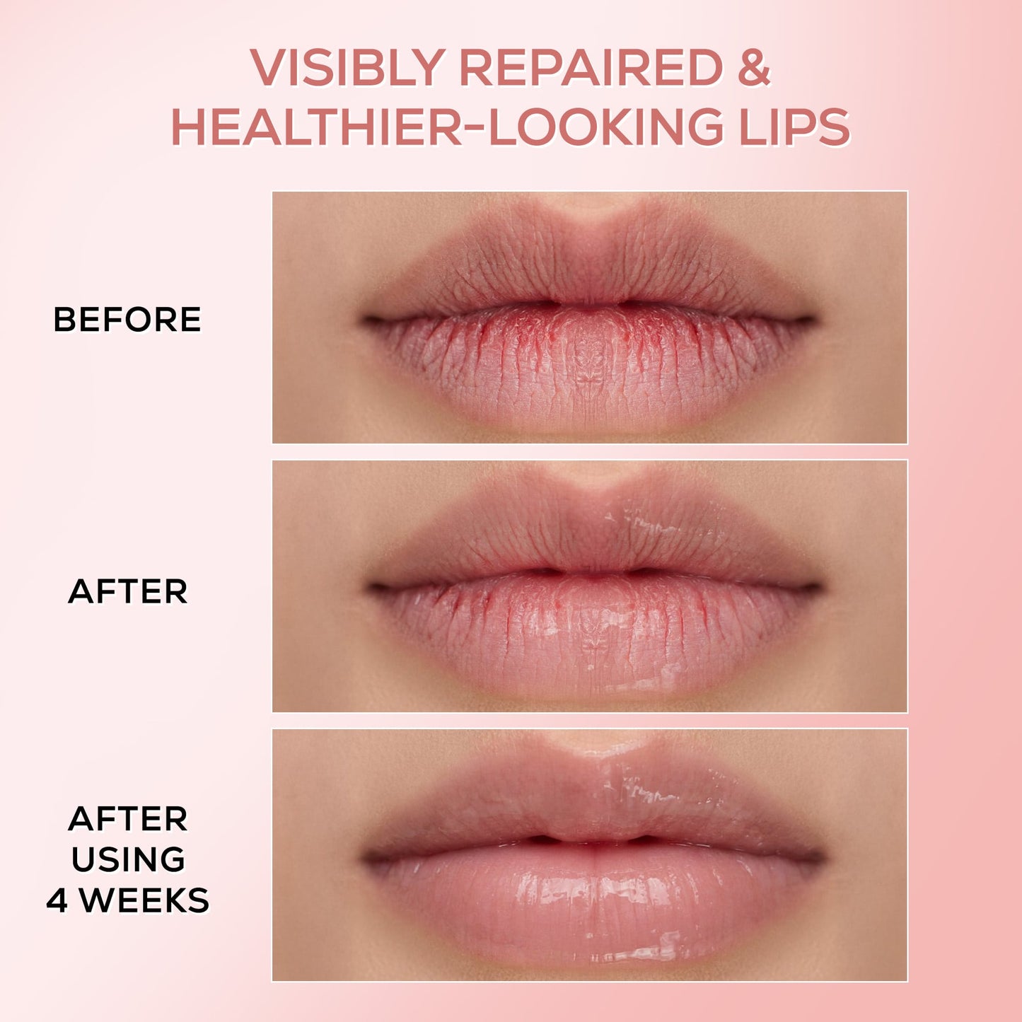 RENEE Pink Therapy PDRN Overnight Lip Repairing & Moisturising Lip Balm For Dry & Chapped Lips, 10g