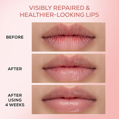 RENEE Pink Therapy PDRN Overnight Lip Repairing & Moisturising Lip Balm For Dry & Chapped Lips, 10g