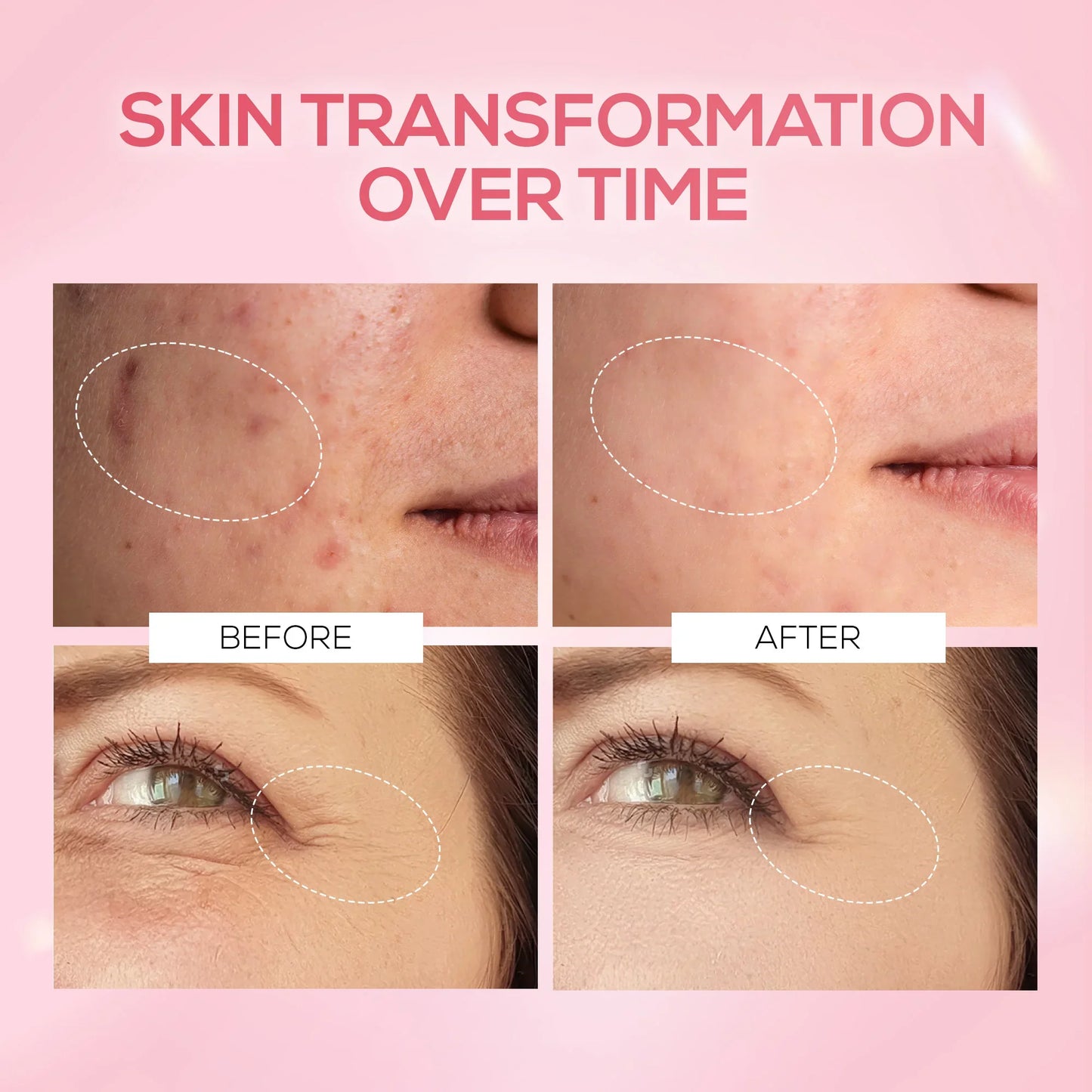 RENEE Pink Therapy PDRN Pink Peptide Serum For Hydrated & Radiant Skin
