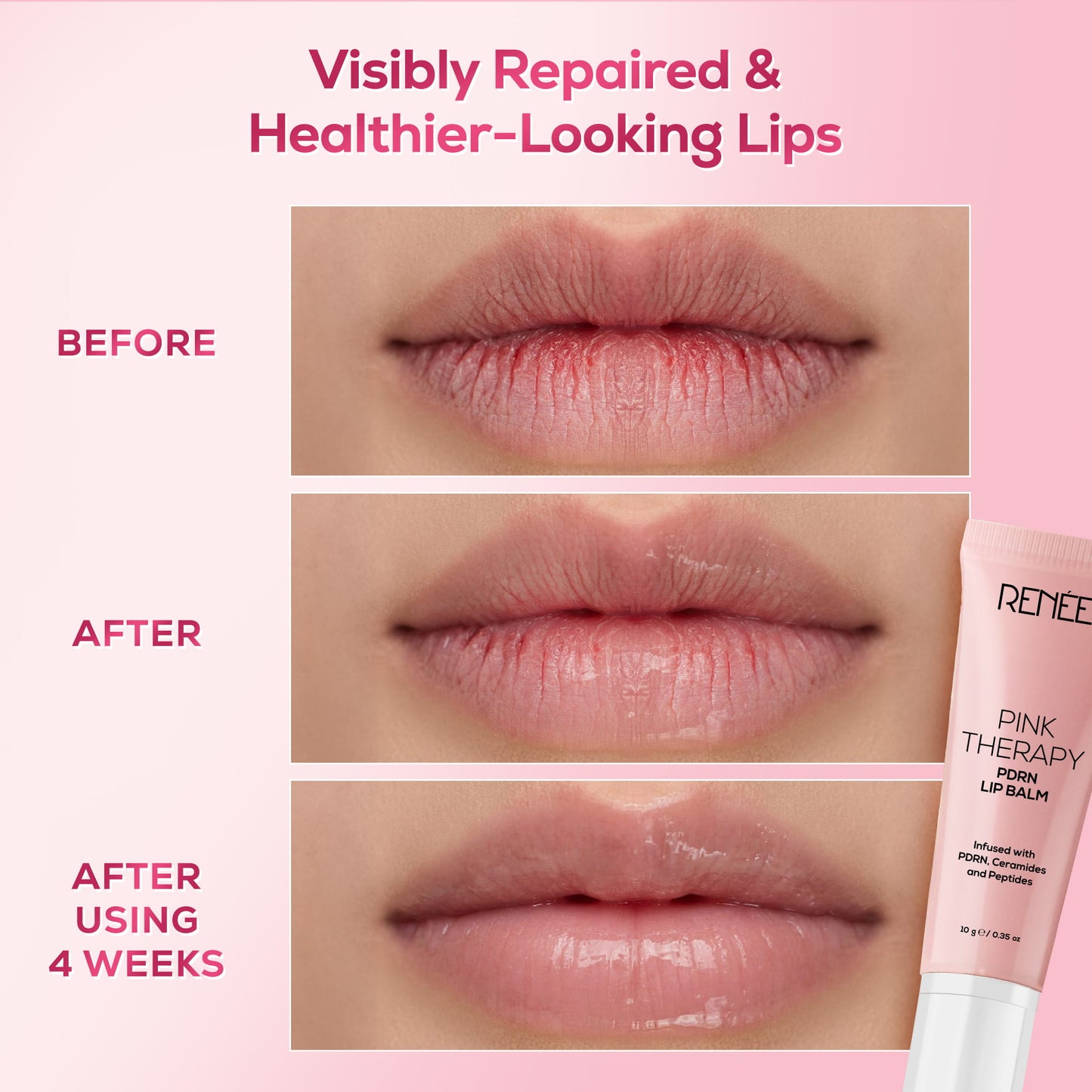 RENEE Pink Therapy Anti-Aging Skincare Combo With Lip Balm