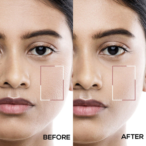 RENEE Face Filters Combo - Renee Cosmetics